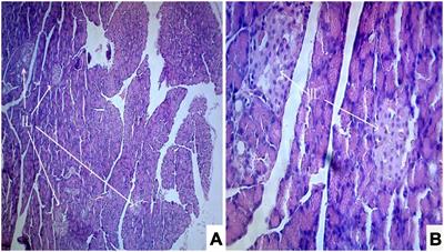 Antidiabetic activity of Solanum torvum fruit extract in streptozotocin-induced diabetic rats